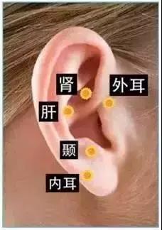 日常生活中如何预防耳鸣专家提醒,耳鸣耳聋保健