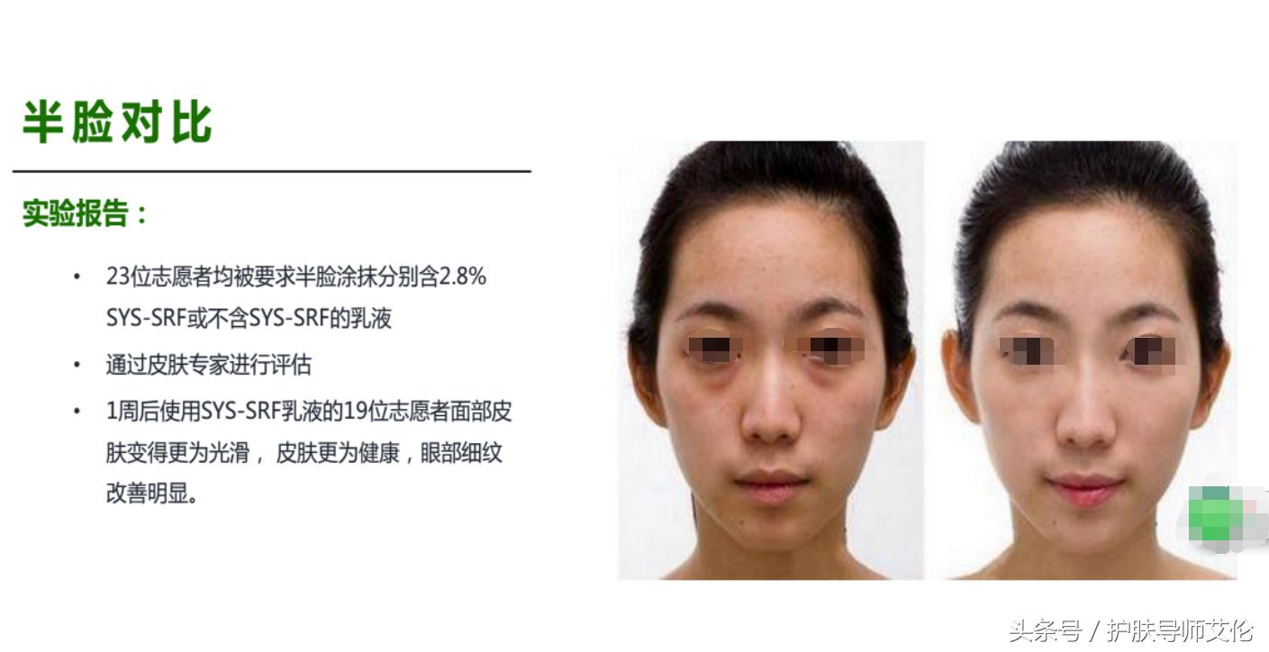 植物祛痘组合价格表,植物草本祛痘