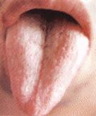 7种舌头暗示健康问题,各种病症舌头的颜色