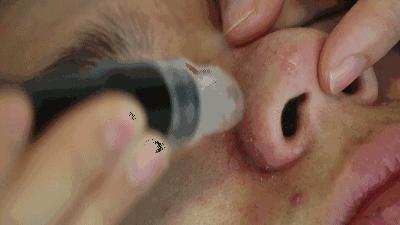 什么是小气泡项目,什么是小气泡