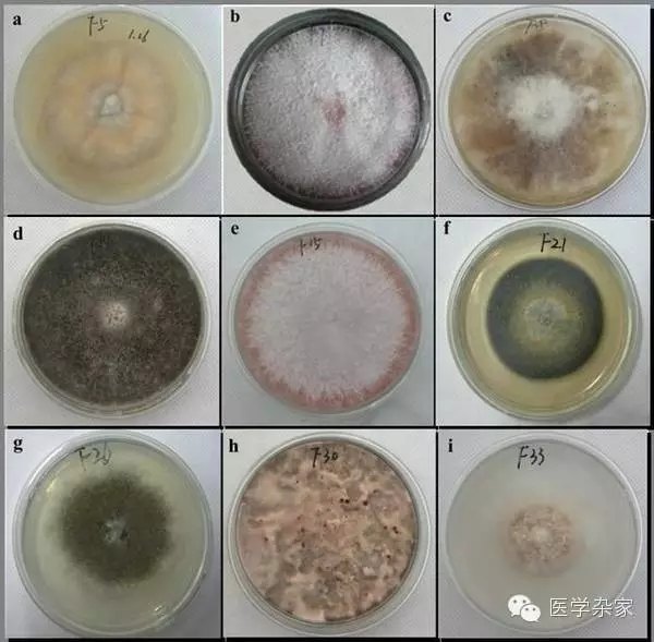 为什么脚气莫名其妙没有了,为什么脚气总是不能断根