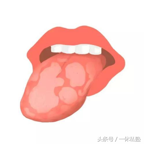 老中医教你观察舌头,老中医教你如何望舌问诊