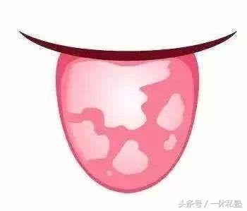 老中医教你观察舌头,老中医教你如何望舌问诊