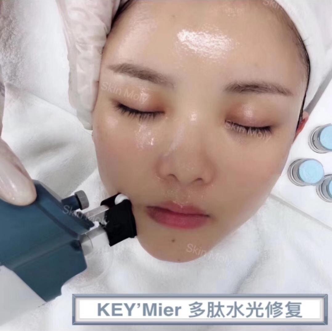 钒钛水光违法吗,钒钛微晶无针水光仪器操作视频