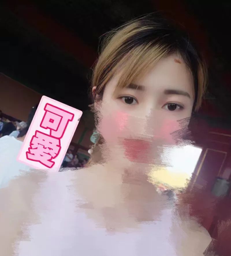 脸部被挠伤怎么不留疤,脸上被挠伤怎样才能不留疤