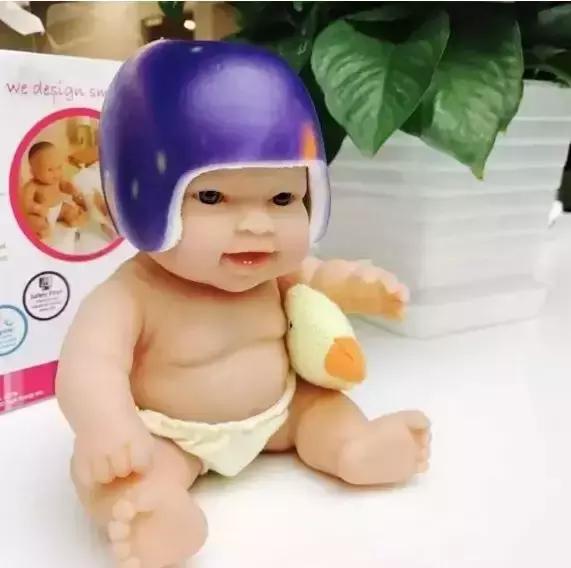 宝宝偏头斜头严重长大了会好吗,宝宝头偏脸歪有什么办法吗