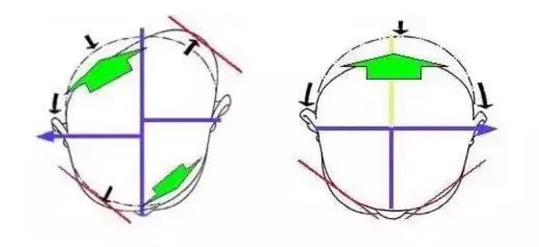 宝宝偏头斜头严重长大了会好吗,宝宝头偏脸歪有什么办法吗