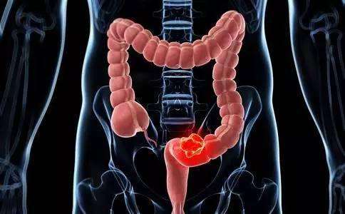 12个最能迷惑人的癌症前兆,10种常见癌症的症状表现记得收藏