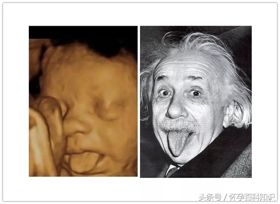 22周胎儿在肚子里的视频,22周胎儿在腹中真实照片