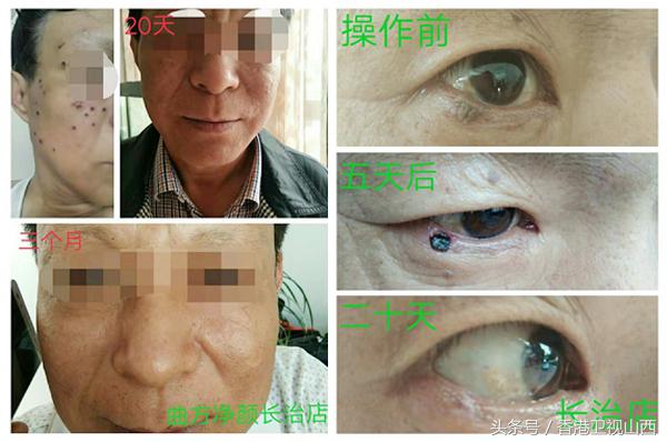 长治曲方净颜,曲方净颜美白产品