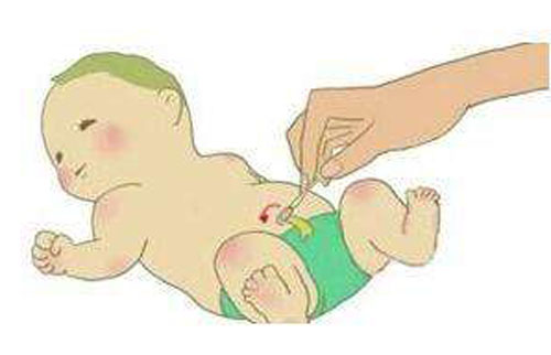 宝宝肚脐突出有脐疝需要注意啥,宝宝肚脐突出脐疝会造成哪些影响