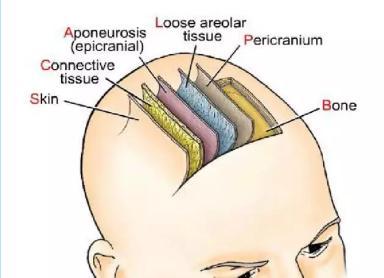 宝宝一出生头上就长这种瘤，如何识别良性OR恶性？新妈妈快来看看