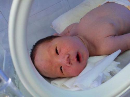 头上长瘤一般恶性的还是良性的,婴儿脑袋长个瘤会不会看出来