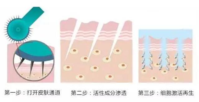 毛孔大皮肤粗糙怎么办,毛孔大皮肤变好