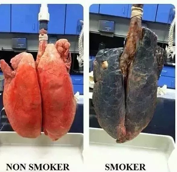 戒烟后如何将肺部清洗干净,戒烟后怎么清理肺部烟毒