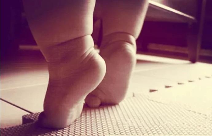 宝宝7个月就走路，担心以后O型腿？骨科医生教你3个方法自查