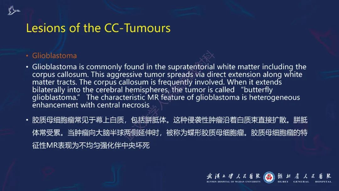 胼胝体肿瘤影像鉴别,胼胝体病变影像诊断