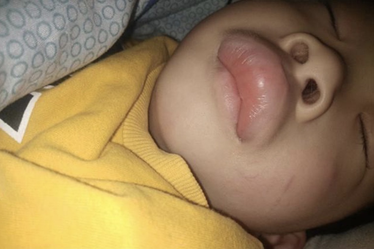 因害怕驱蚊产品有毒放弃驱蚊?帕达诺教你拒绝恶魔在身边