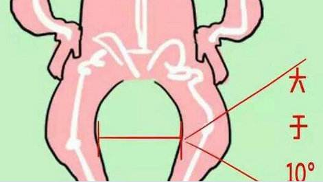 宝宝腿什么样需要矫正,怎么判断宝宝腿型是否正常