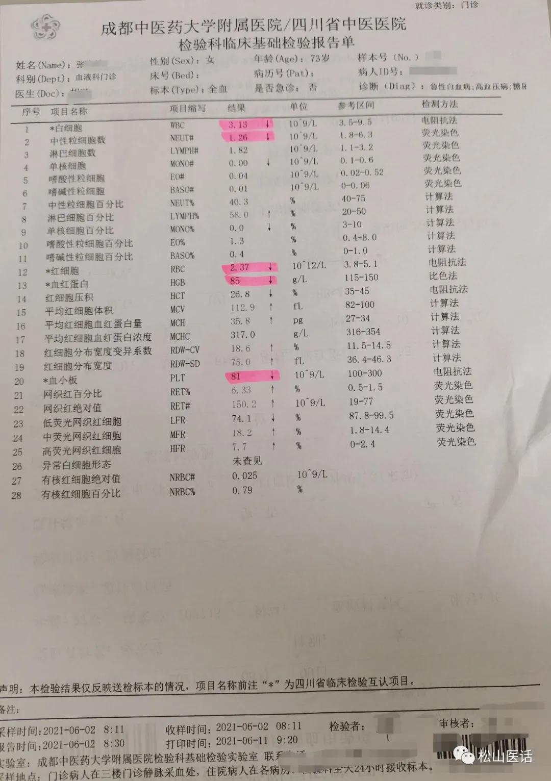 松山医话刘松山教授,松山医生看骨髓增殖性肿瘤怎么样