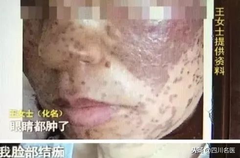 华佗国药祛斑丸是真的吗,华佗祛斑美白产品