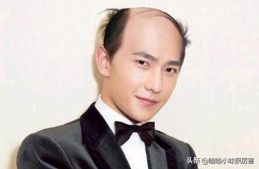 有刘海才好看的明星,有刘海超好看的明星