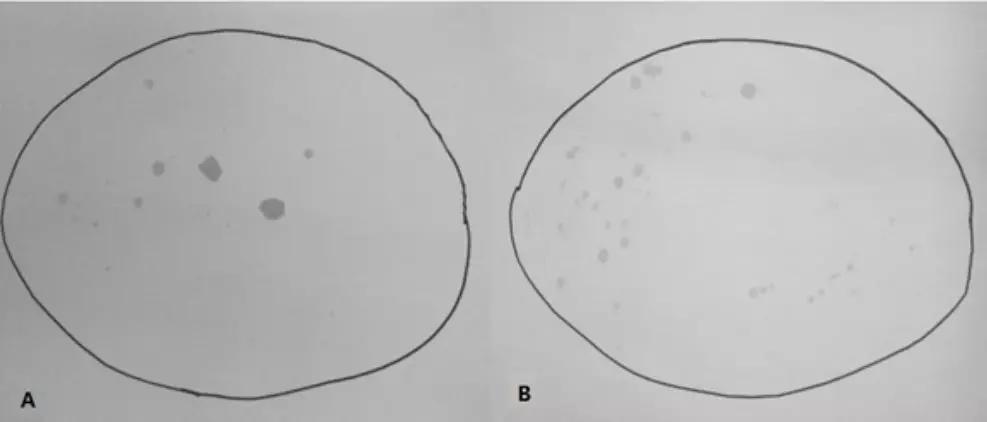 气溶胶的防范方法,四个小妙招预防气溶胶