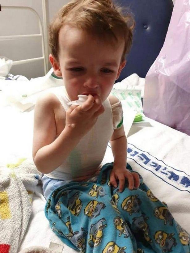 两孩子被烧伤,两小孩被烧伤