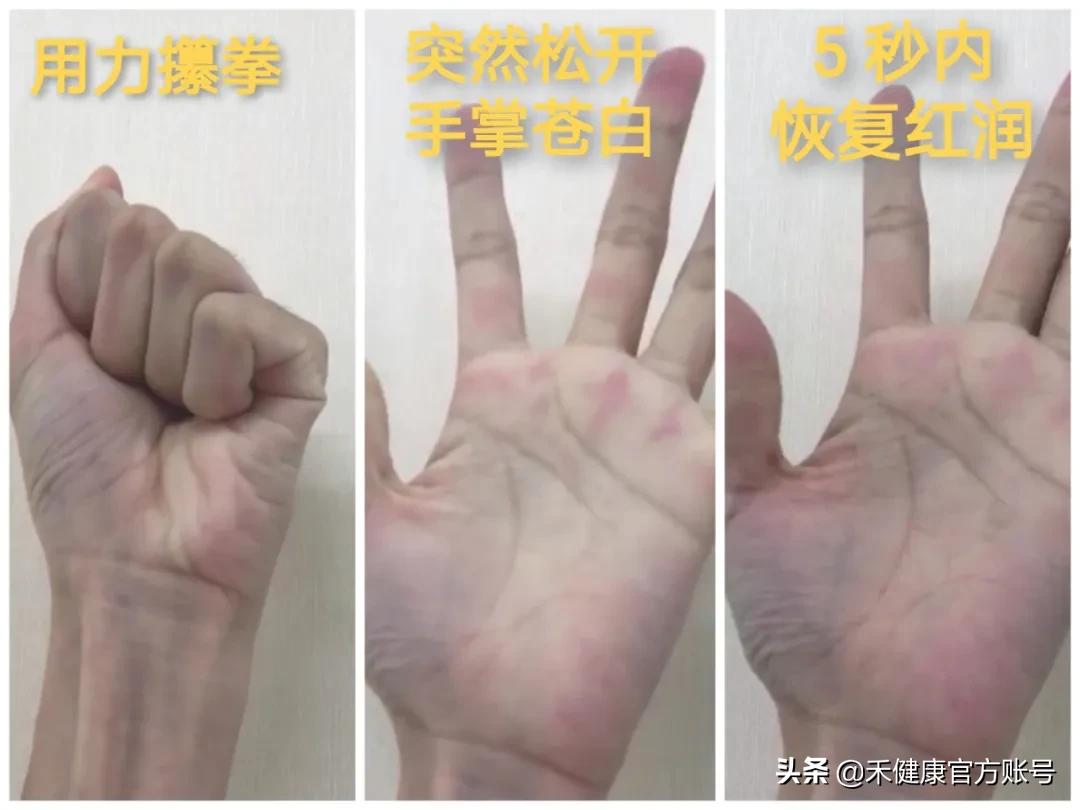 气色差怎么快速恢复气色,气色太差了怎么办