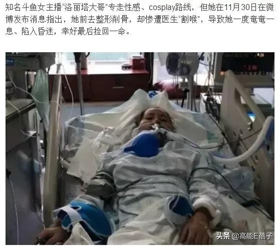 微整形需要多久,最受欢迎的5大微整形