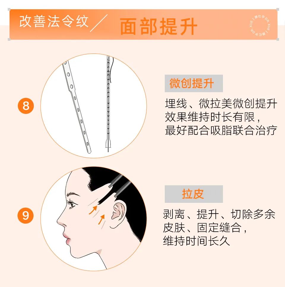 法令纹怎么改善脸部衰老,改善法令纹按摩手法视频