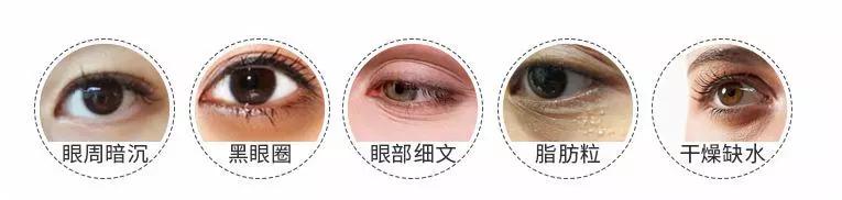 眼容易肿有黑眼圈,黑眼圈肿眼泡有什么小妙招