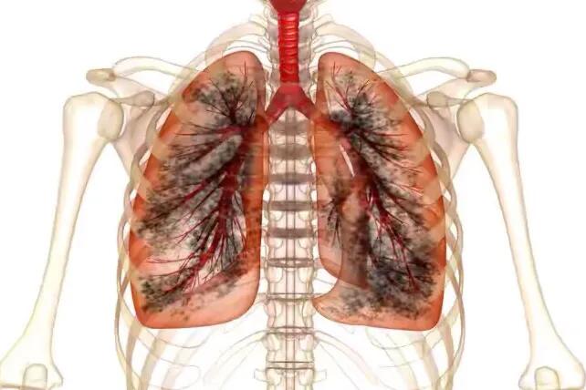 业主担心装修材料环保怎么解决,业主装修污染有哪些