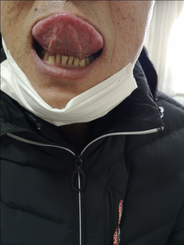 腹部胀满情志焦虑多梦易怒,腹部神经痛焦虑症