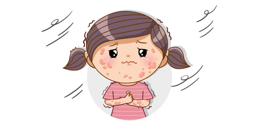 从出生一直都有荨麻疹是什么情况,怎么会得荨麻疹要注意5个原因