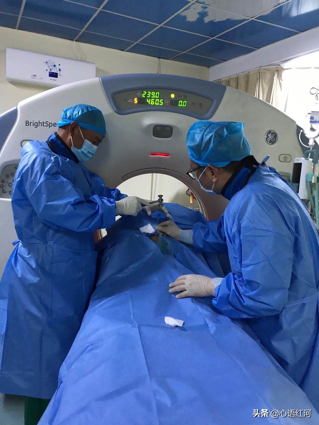 红河州第三人民医院肿瘤微创介入,红河州肿瘤医院技术怎样