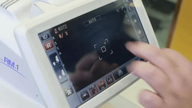 徐州近视眼,徐州近视500度