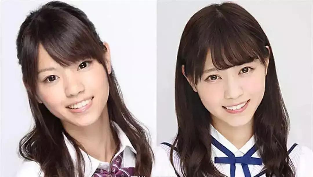 刘梓晨到底有没有整容啊,还记得整容界网红刘梓晨吗