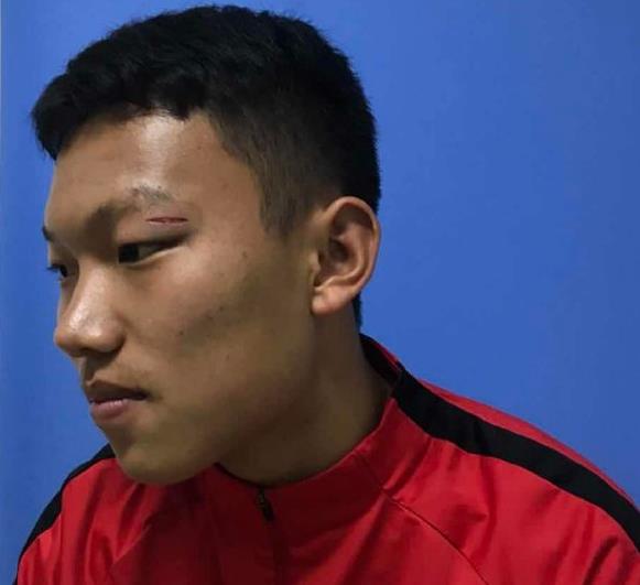 足球场上令人气愤的瞬间,足球比赛各种扎心场面