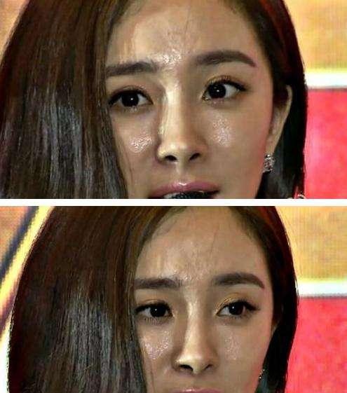 毛孔粗大怎么办最有效收缩毛孔,毛孔粗大收缩毛孔最有效方法实测