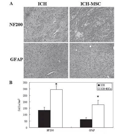 干细胞治疗脑卒中后遗症的新药,日本神经干细胞治疗脑出血后遗症