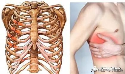 “万恶的”胸痛之七大疾病（上）