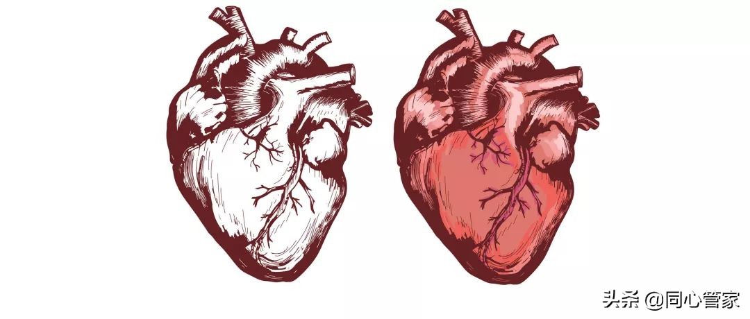 对心脑血管疾病有效果的药丸,心血管专用保健品