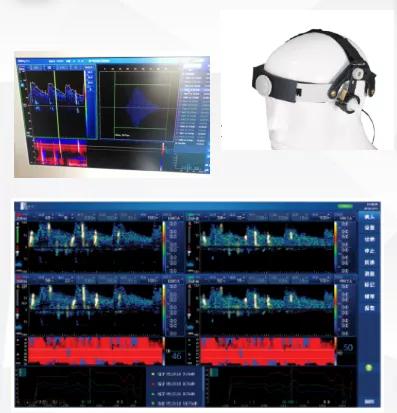 心脑血管微循环检测仪器,心脑血管检查仪