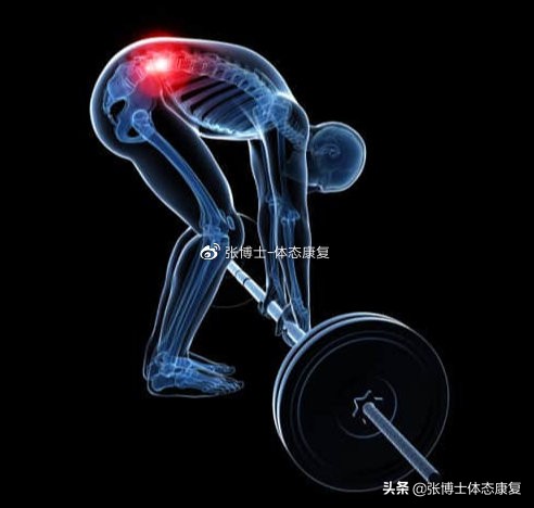 运动腰肌损伤怎么恢复,运动康复腰椎失稳