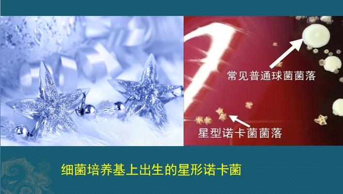 肺诺卡菌感染,当1种分解落叶的细菌,被吸入肺脏