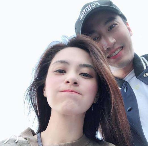 阿娇头部受伤缠绷带照曝光,阿娇受伤后拆绷带首露面