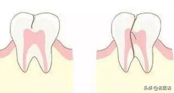 牙齿吃雪糕敏感怎么办,牙齿吃冰的就特别敏感怎么办