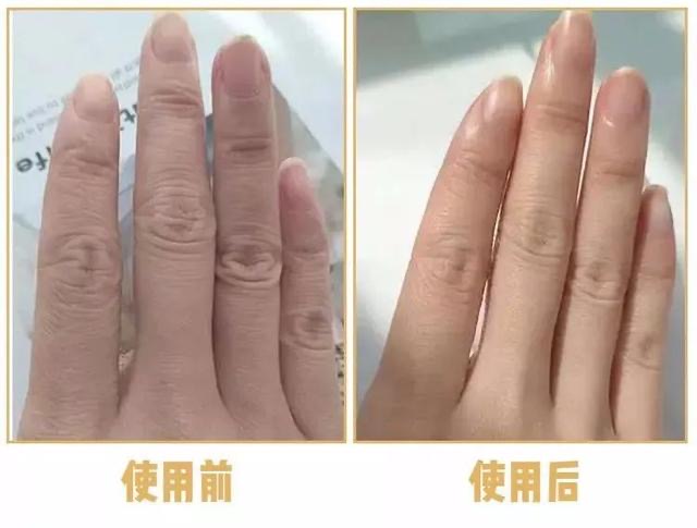 日本蜂王乳面霜,日本的霜好用不过敏干性皮肤用