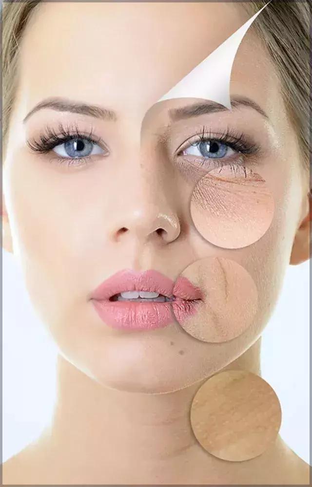 线雕5年后的变化图片,做了线雕以后的注意事项